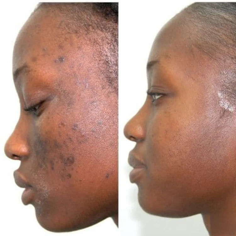 SÉRUM RÉGÉNÉRANT PDRN  + COLLAGÈNE PEPTIDE