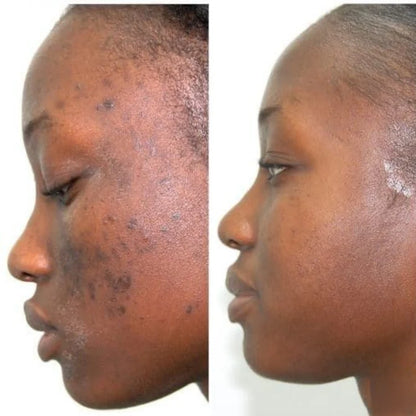 SÉRUM RÉGÉNÉRANT PDRN  + COLLAGÈNE PEPTIDE