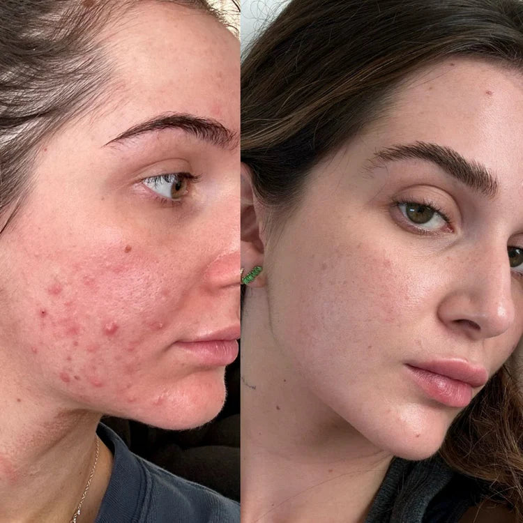 SÉRUM RÉGÉNÉRANT PDRN  + COLLAGÈNE PEPTIDE