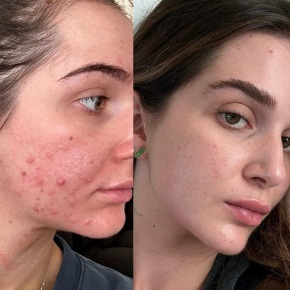 SÉRUM RÉGÉNÉRANT PDRN  + COLLAGÈNE PEPTIDE